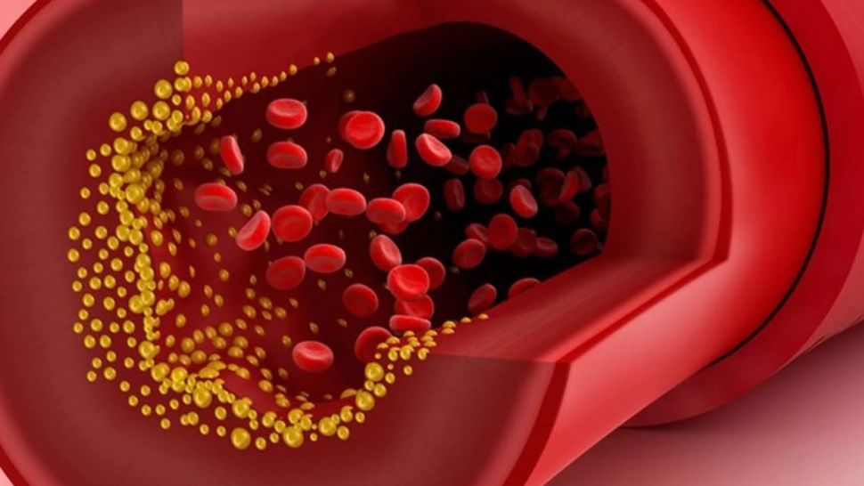 Metoda naturală de curățare a arterelor înfundate - fructul pe care trebuie să-l consumi săptămânal