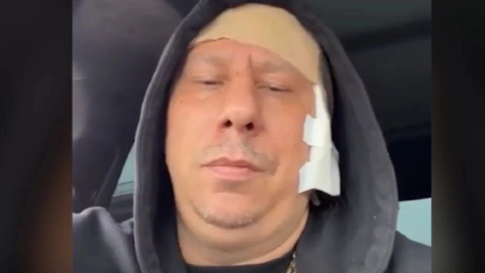 Prima reacție a patronului de restaurante din Capitală, atacat de motocicliști: "M-au zgâriat pisicile puțin..." - Un MARTOR rupe tăcerea: cum a decurs atacul