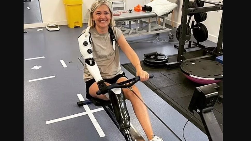  80% om, 20% robot! O femeie din Marea Britanie va folosi un braț bionic care are la bază inteligența artificială