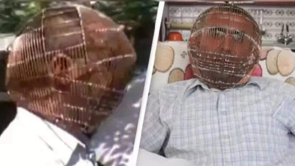 Povestea tulburătoare a bărbatului care și-a băgat capul într-o cușcă de cupru pentru a se lăsa de fumat