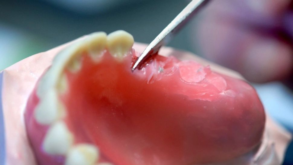 Cum scapi, cu adevărat, de mirosul neplăcut din gură. Nu te-ai fi gândit la așa ceva