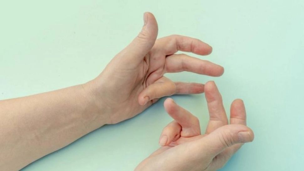 Ce este boala "Viking"? Secretele afecțiunii care-ți blochează degetele mâinilor