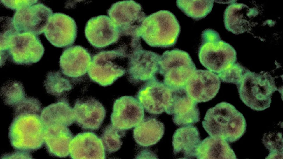 Amiba care mănâncă creierul oamenilor - un nou DECES în 2 săptămâni - De ce canicula crește pericolul mortal