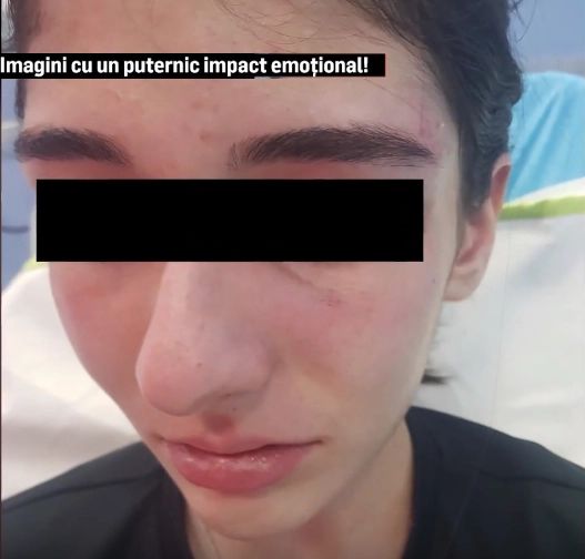 Bătăușele care au desfigurat-o și umilit-o pe colega lor au fost lăsate în libertate! Apel disperat al mamei victimei 