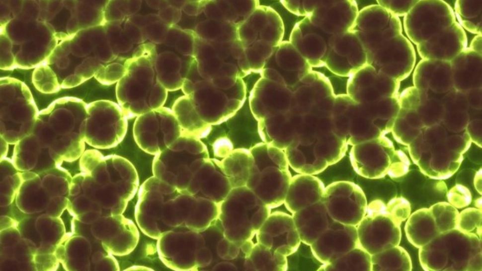 Focar de antrax: alertă maximă în România. Cum se răspândește boala