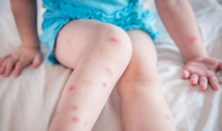 Cum ne detectează ȚÂNȚARI? Degeaba stingem lumina, nu ajută cu nimic, sunt precum dronele  