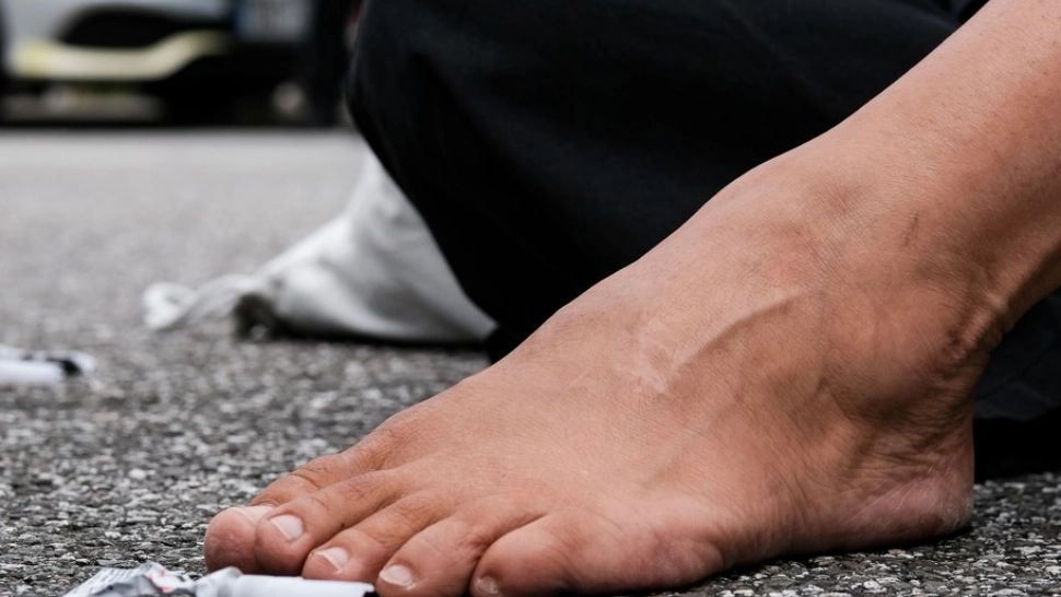 Puneți pastă de dinți pe tălpile picioarelor. Efectul este incredibil, rețeta extraordinar de simplă 