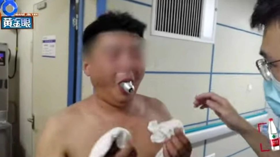 Provocarea de pe internet care a trimis oamenii la urgență. Medicii, nevoiți să le scoată pacienților becurile din gură 