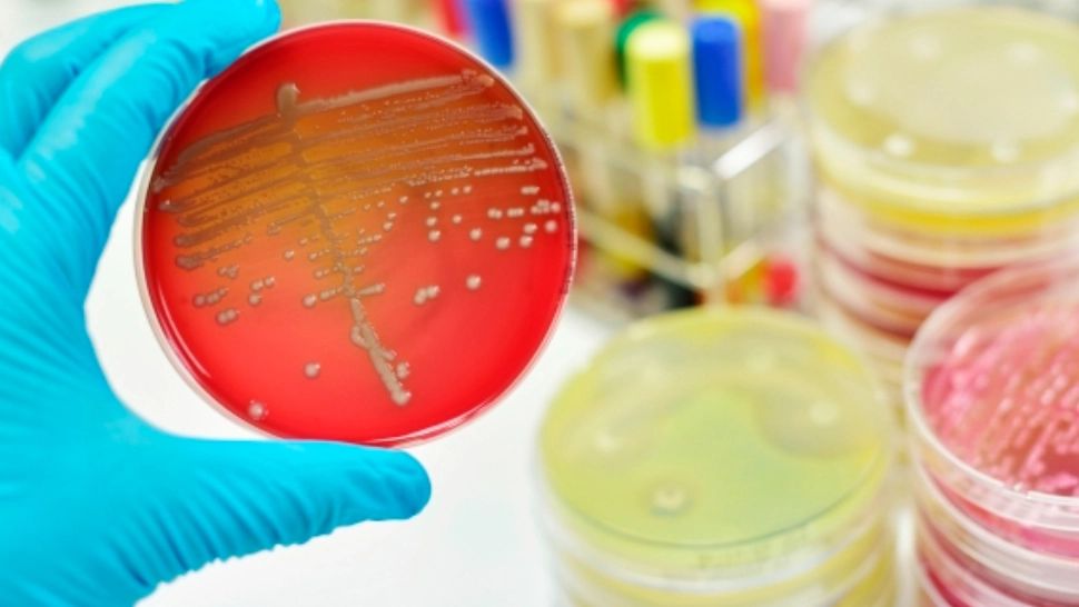 Amenzi de peste 45.000 de lei după nunți cu toxiinfecție alimentară în Alba - Zeci de persoane, inclusiv un copil, la spital, cu stafilococ auriu