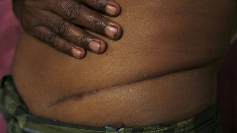  Rețea de traficanți de organe, destructurată. Sute de rinichi, extirpați de la pacienți și vânduți bogaților - Profituri uriașe 