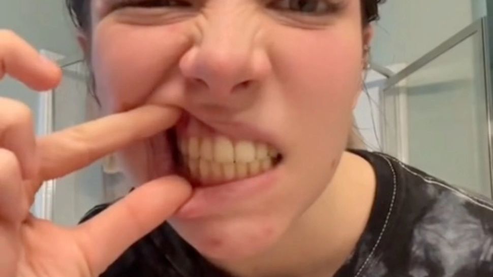 Cum îți albești dinții în mod natural. Metode inedite, dar eficiente