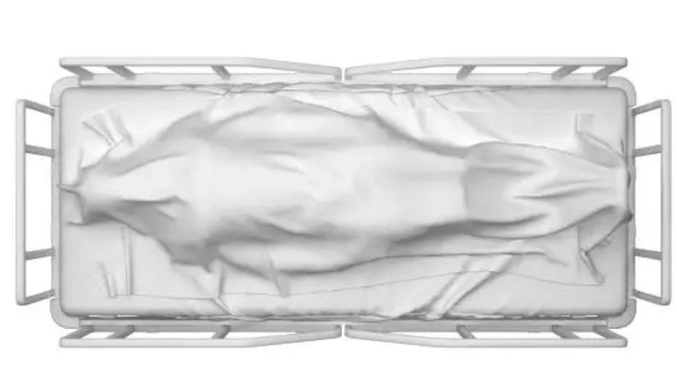 Oamenii de știință au descoperit a "treia stare" între viață și moarte. Teoria celulelor Frankenstein