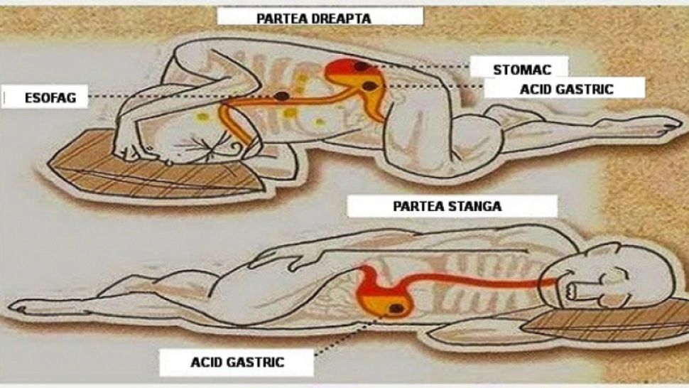 Pe ce parte este, de fapt, bine să dormi? Medicii vin cu argumente și prezintă o schemă prin care răspund la această dilemă  