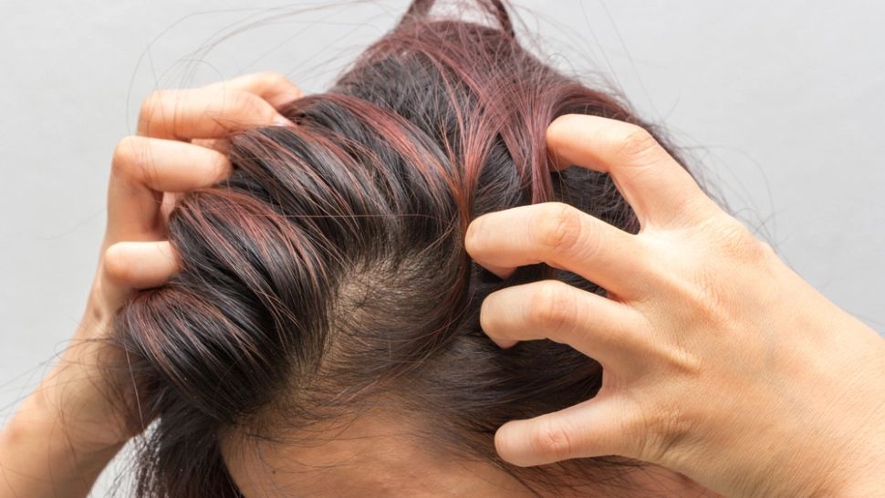 Simți deseori mâncărime la nivelul capului? Corpul transmite, de fapt, un semnal de alarmă