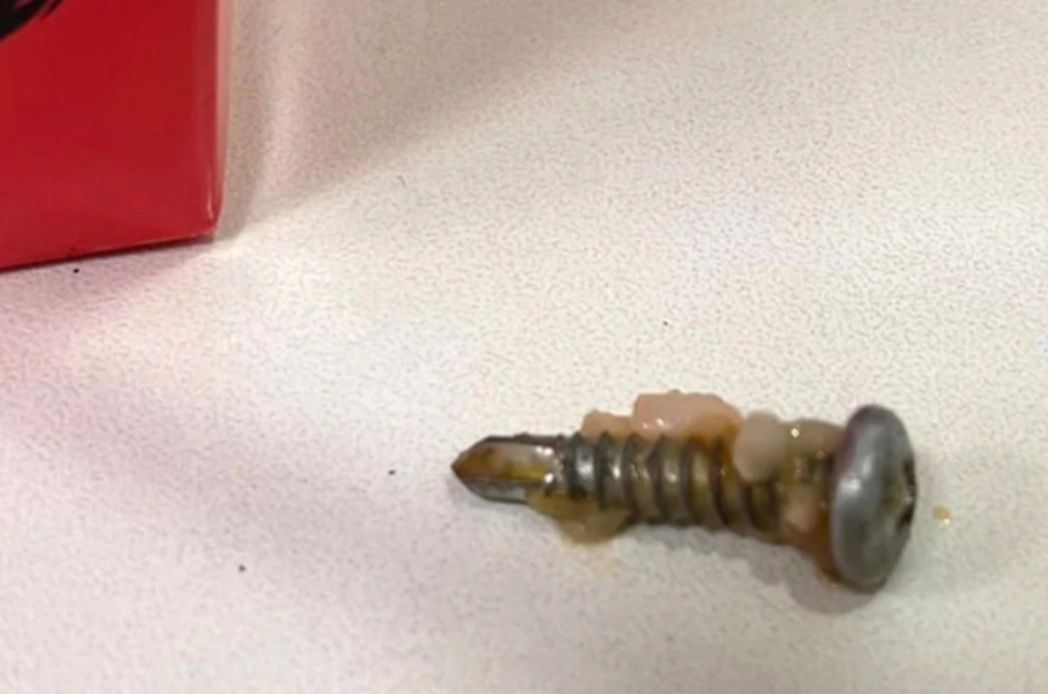 "Surpriza" descoperită de o tânără din Cluj în mâncarea chinezească comandată: UN ȘURUB