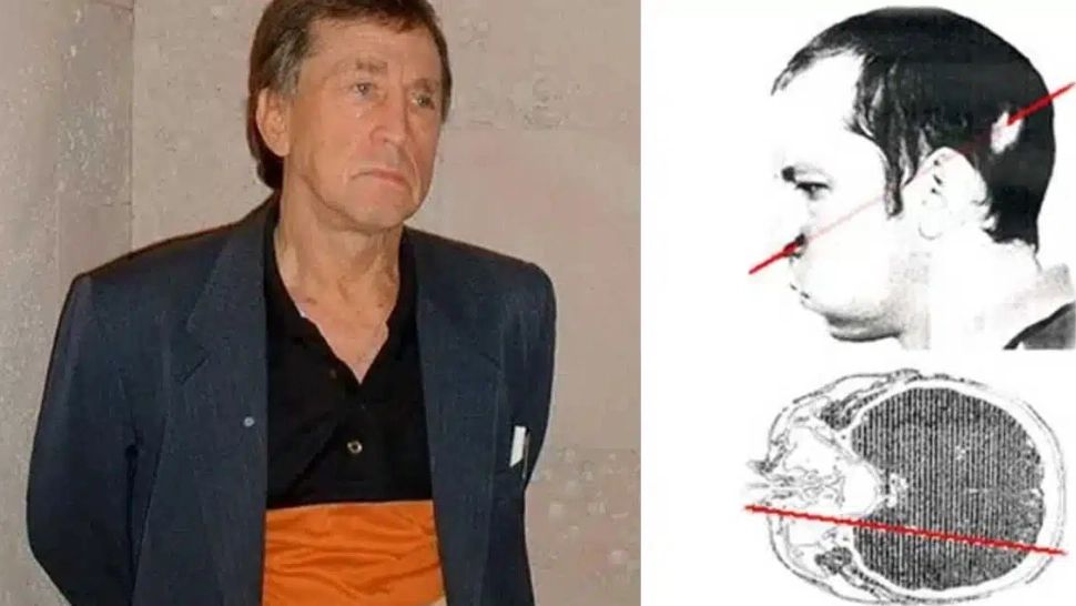 Și-a băgat capul în aceleratorul de particule și prin creier i-a trecut o rază ca de LASER. Accidentul i-a SCHIMBAT viață