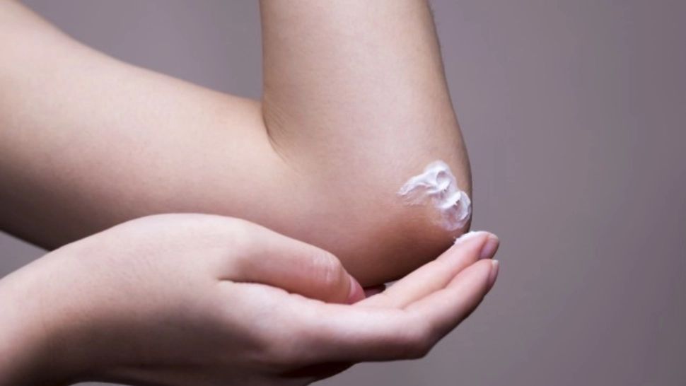 Ce înseamnă dacă ai coatele mai închise la culoare. 5 substanțe la îndemână care te scapă de această problemă