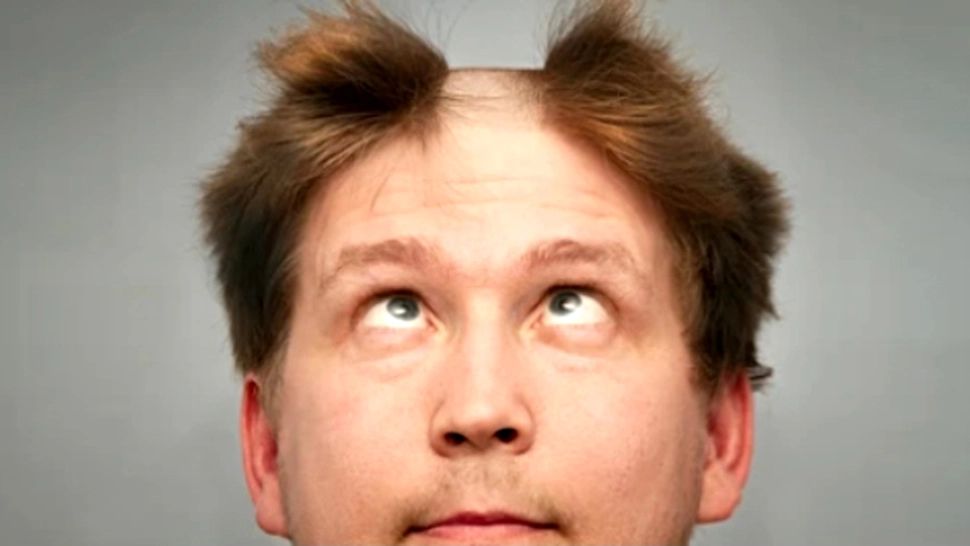 Franța interzice discriminarea unei persoane pe baza coafurii sau cheliei și o consideră oficial infracțiune