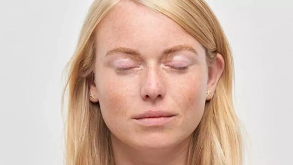 Semnul de pe față care ar trebui să te trimită la cardiolog. Apariția sa arată o afecțiune seioasă