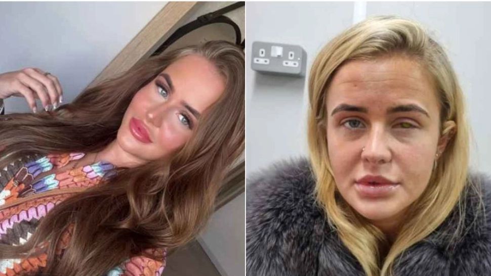 Momente șocante pentru o tânără de 22 de ani: a rămas oarbă după ce și-a pus extensii de gene