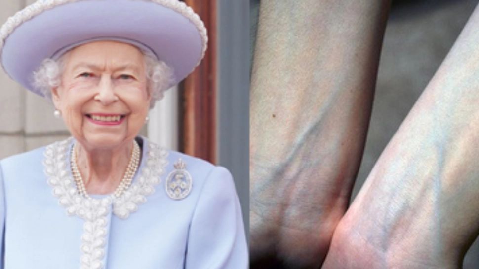 De ce se spunea despre aristocrați că au „sânge albastru”? Explicația este mult mai simplă decât ți-ai fi putut imagina