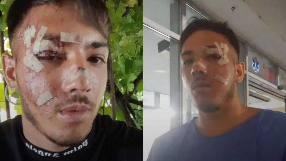 Marian a scăpat ca prin minune în urma unui accident rutier mortal. Duba în care se afla s-a făcut praf după ce a intrat în coliziune cu o autoutilitară - VIDEO