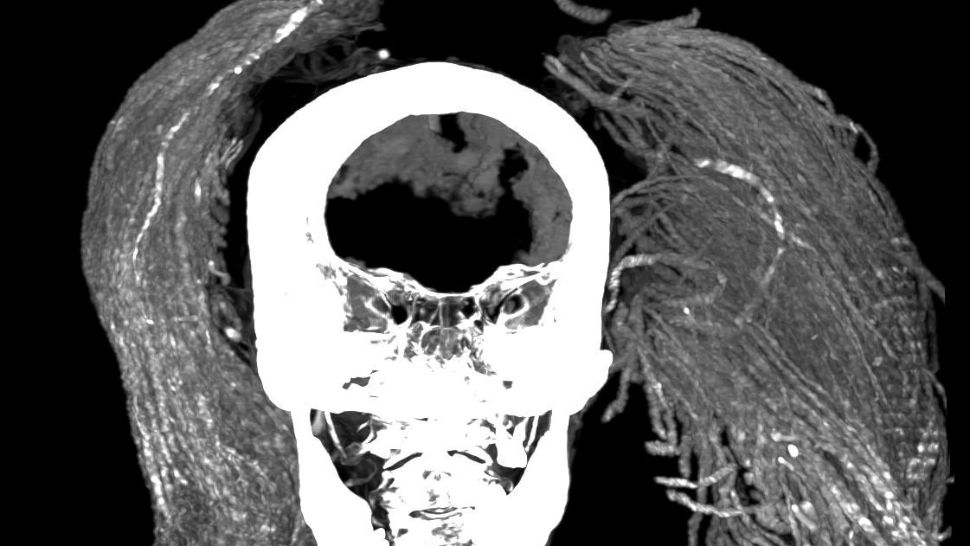 Misterul "MUMIEI urlătoare", dezlegat. De ce a murit cu o grimasă atât de înfiorătoare?