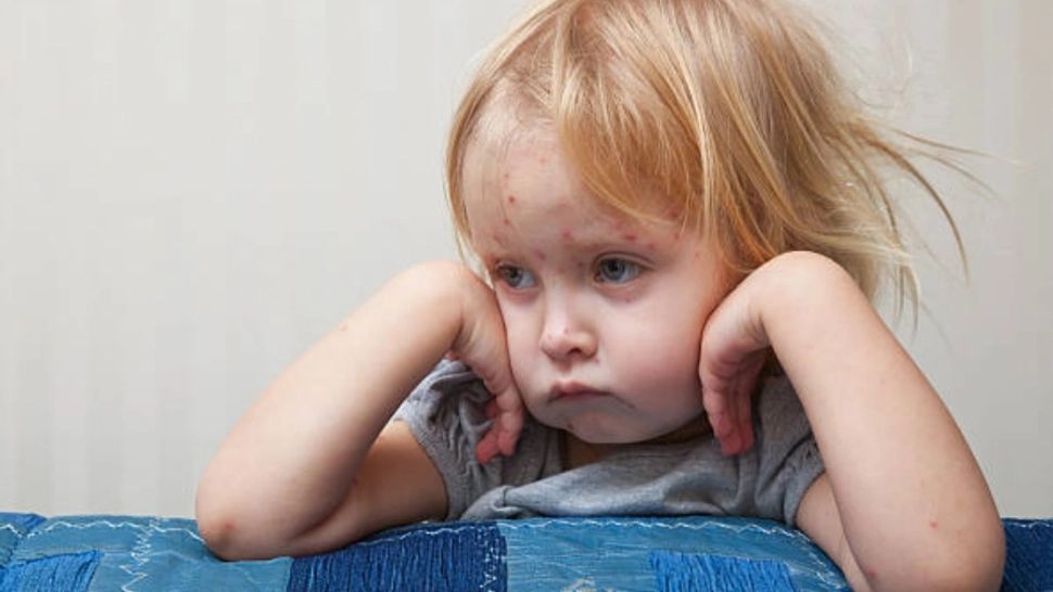 Alertă în sistemul medical: România, la un pas de a declara epidemie de rujeolă. Val de îmbolnăviri, complicații neurologice grave