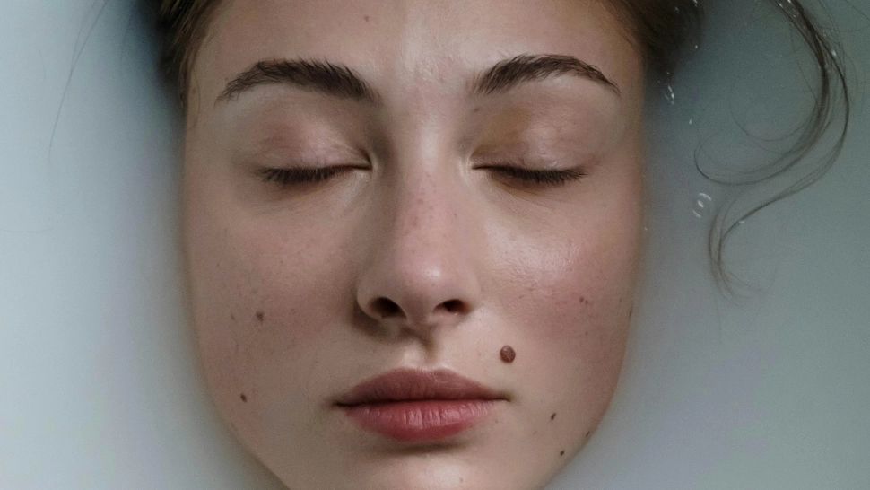 Ce destin vei avea dacă ai alunițe pe față și corp