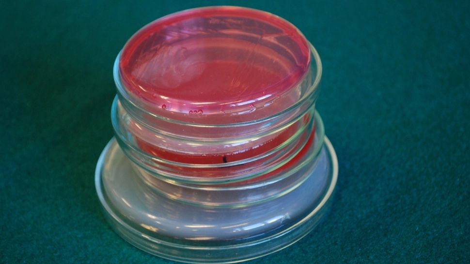 Tulpină de holeră, în România? Ministerul Sănătății, precizări importante despre pacientul de la Victor Babeș