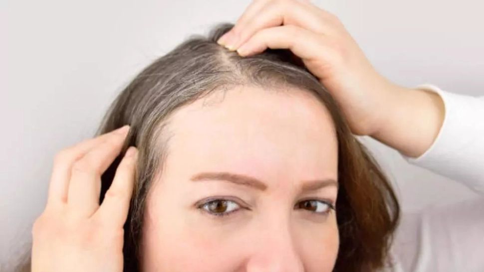 Cinci motive pentru care albești mai devreme. Unele boli autoimune se numără printre ele