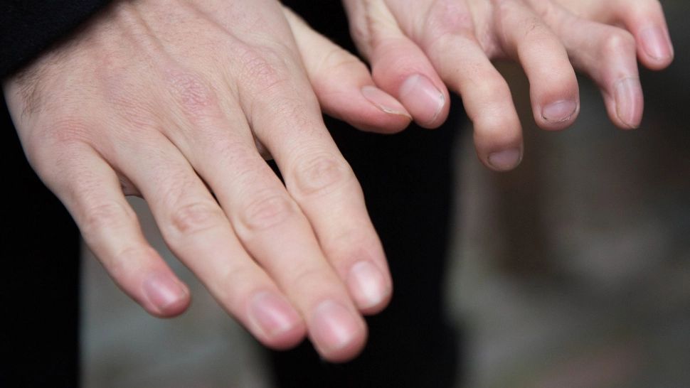 Arătătorul mai lung decât inelarul? Care e legătura între lungimea degetelor și consumul de alcool?