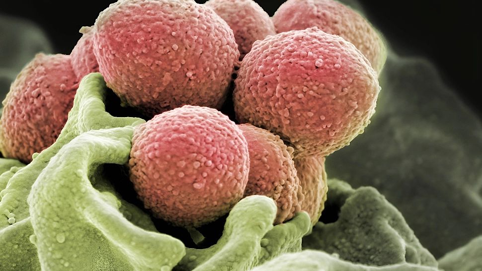 Streptococul care "devorează" corpul face ravagii în SUA. Numărul cazurilor a explodat, iar tratamentul nu mai dă rezultate