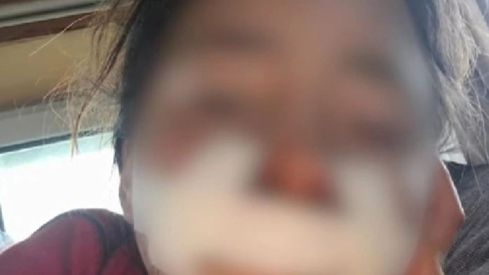 Coșmar în familie: doi frați din Arad au fost bătuți și înfometați de proprii părinți. Tatăl le-a cusut rana cu o sfoară