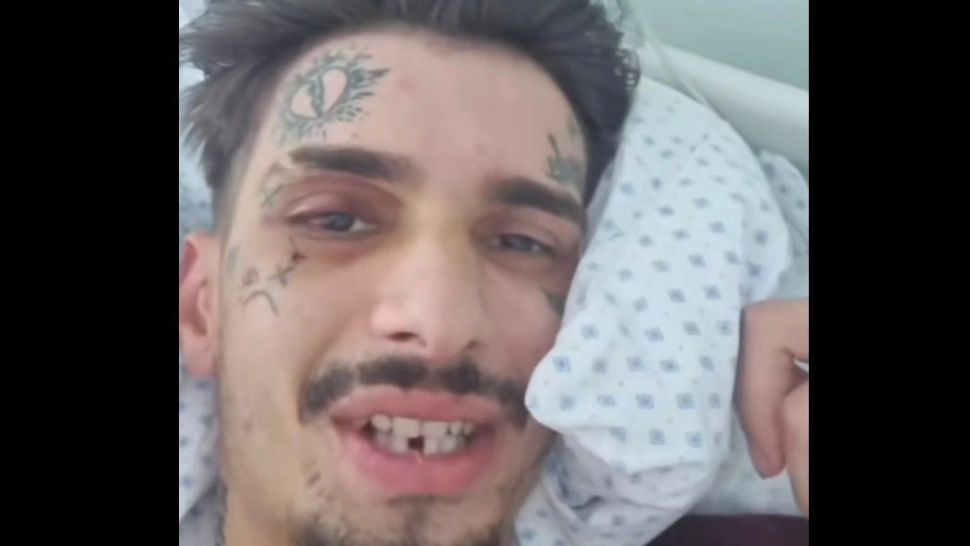 Artist de 23 de ani, mort la doar 23 de ani. A fost bătut crunt în urmă cu un an, la un festival de pe Litoral