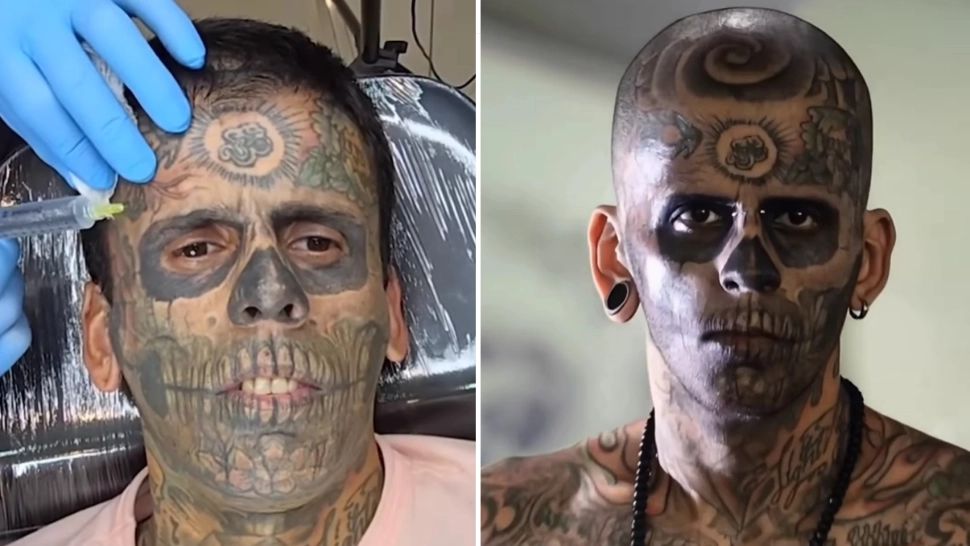 Cum arată bărbatul care și-a „șters” tatuajele ce îi acopereau 90% din corp? Transformarea este șocantă - FOTO/VIDEO