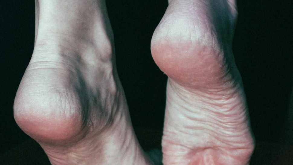 Remediul din bucătărie care te scapă de călcâiele crăpate. Este vorba despre un singur ingredient care îți va face pielea fină și moale