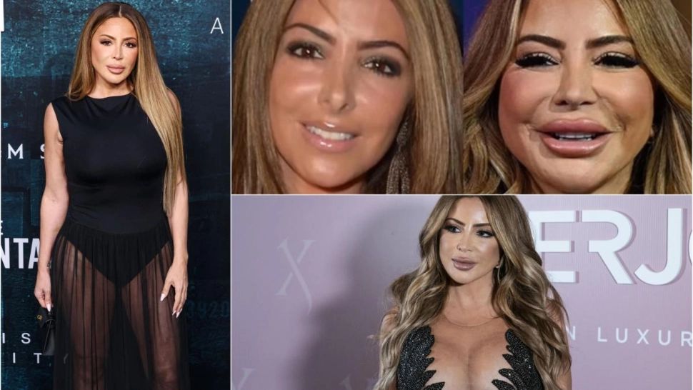 Clipe șocante pentru o actriță. I s-a schimbat fața după o reacție alergică la un tratament estetic