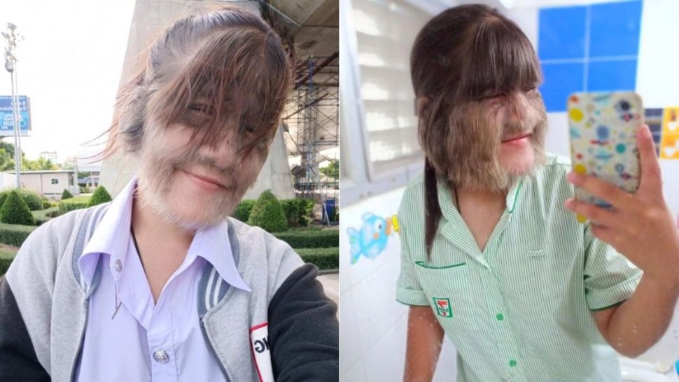 Povestea impresionantă a celei mai păroase femei din lume. Cum arată astăzi după ce s-a căsătorit?