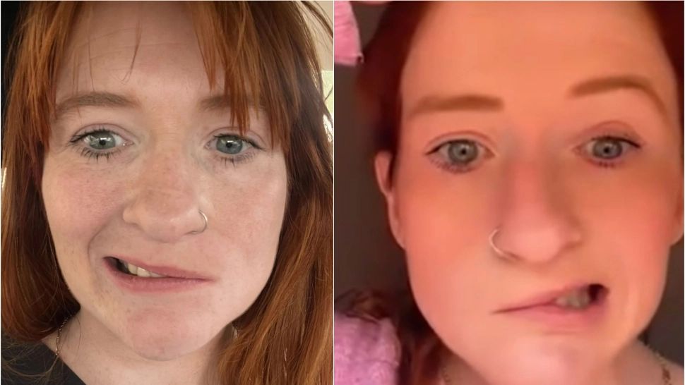 Durerea unei tinere mame! I-a paralizat jumătate de față după ce a consumat o băutură banală: „Viața mea s-a schimbat complet”