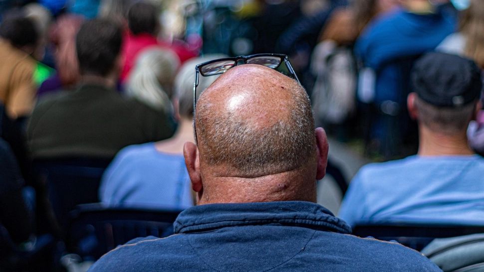 Tragedie în Turcia: un bărbat venit pentru implant de păr și tratament dentar a murit la scurt timp după proceduri