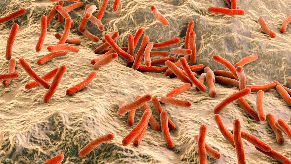 Caz rar de lepră confirmat într-o țară din Europa. Autoritățile explică sursa infectării