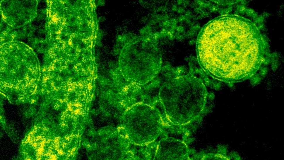 Cât de contagioasă este lepra? Ce spun specialiștii