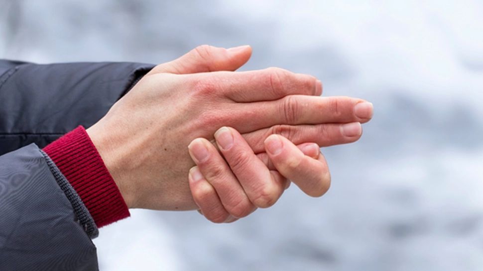 Boala ascunsă în spatele spatele mâinilor reci. Semnalul care îți indică că nu este o reacție normală la frig 