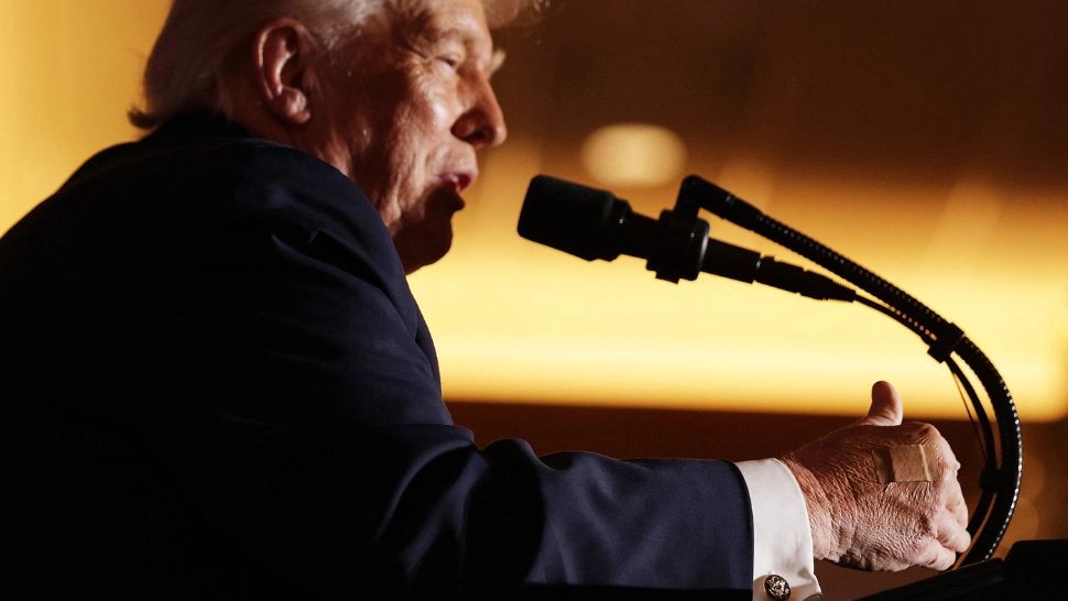 Casa Albă explică motivul pansamentelor de pe mâna lui Donald Trump: „De la strângeri de mâini și aspirină zilnică”