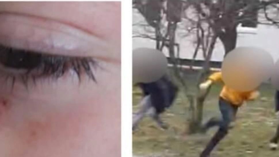 Incident grav la o școală din Maramureș: băiat de 12 ani, lovit de două colege. Poliția a deschis o anchetă