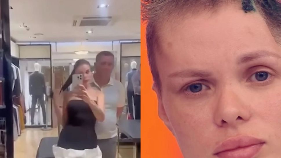 Imagini șocante cu modelul agresat de iubit: tânăra de 33 de ani a suferit o intervenție pe creier după atacul violent