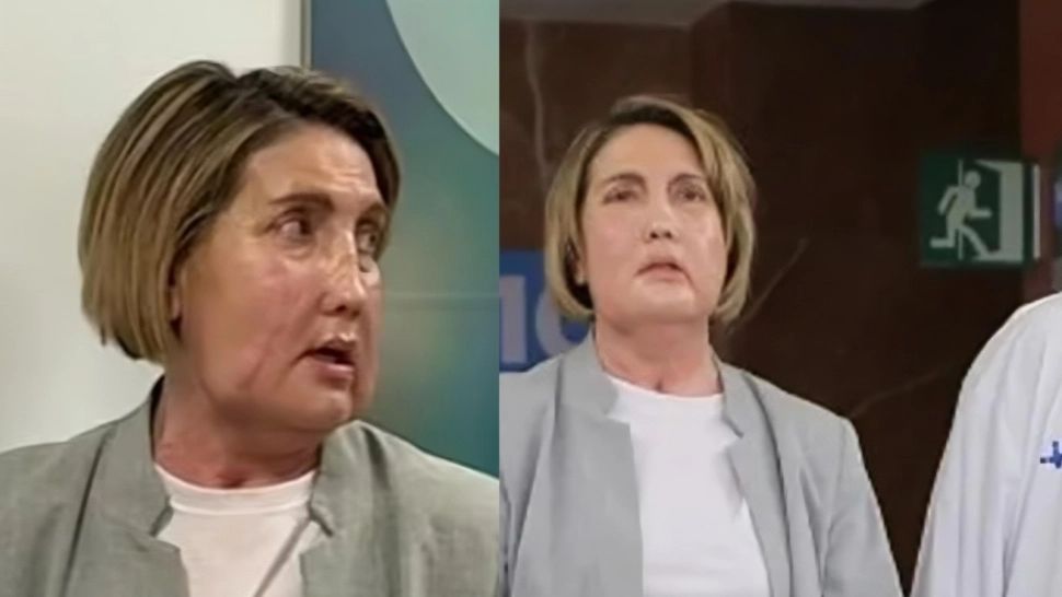 Premieră medicală în Spania: transplant total de față de la o pacientă care a ales eutanasierea