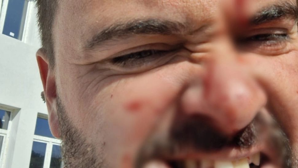 Bătaie la un meci de copii în Bihor: antrenor lovit cu pumnii și picioarele sub ochii juniorilor chiar de părinții acestora