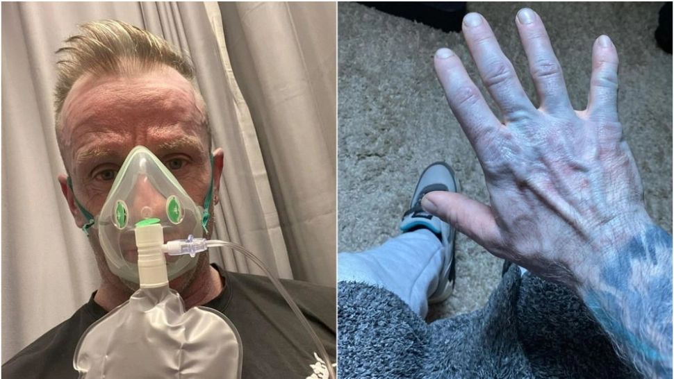 Un bărbat a ajuns la spital după ce s-a trezit complet albastru. Explicația i-a făcut pe medici să râdă